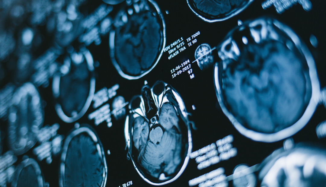 Pre-owned X-ray Equipment